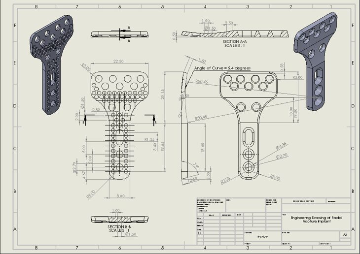 Engineering drawing of the porous radial fracture fixation plate with dimensions and cross-sections